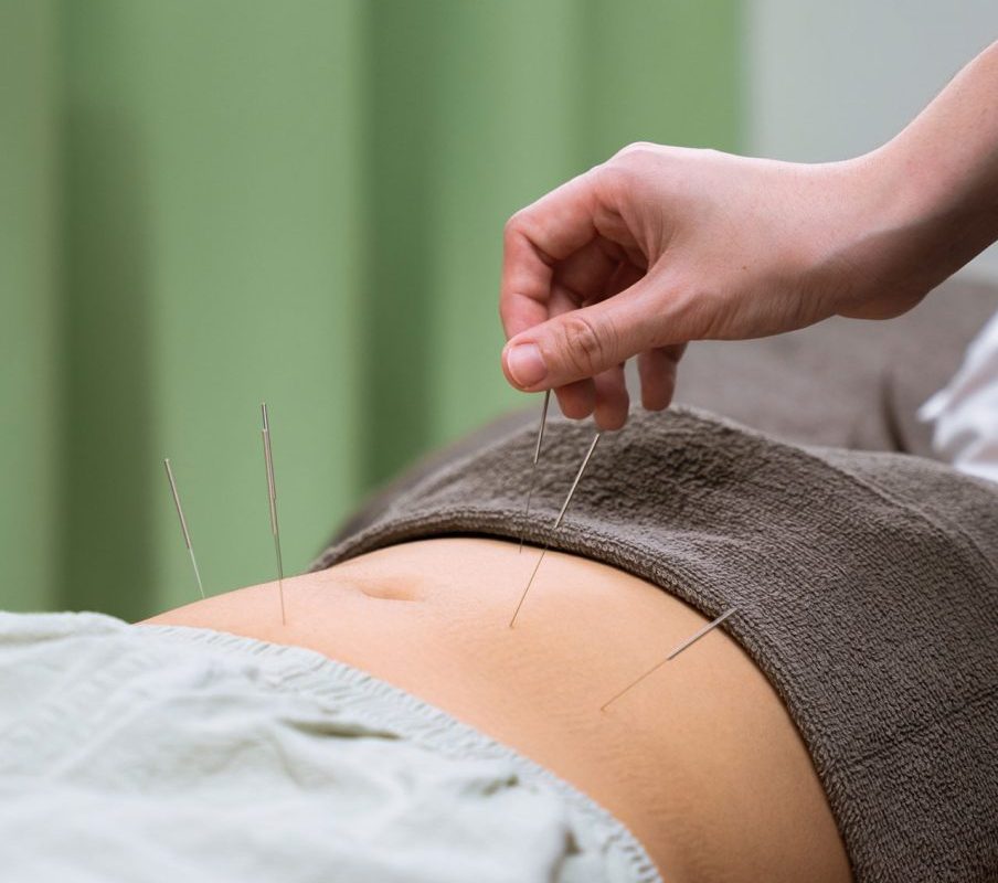 طب سوزنی لاغری