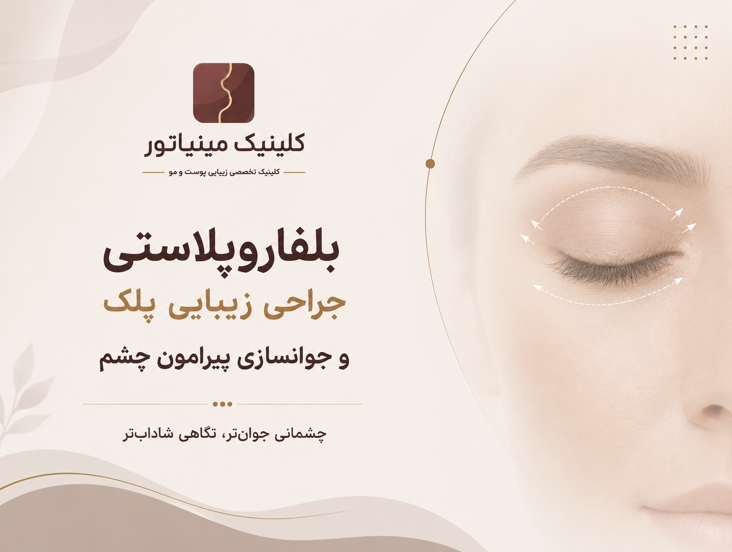 بلفاروپلاستی