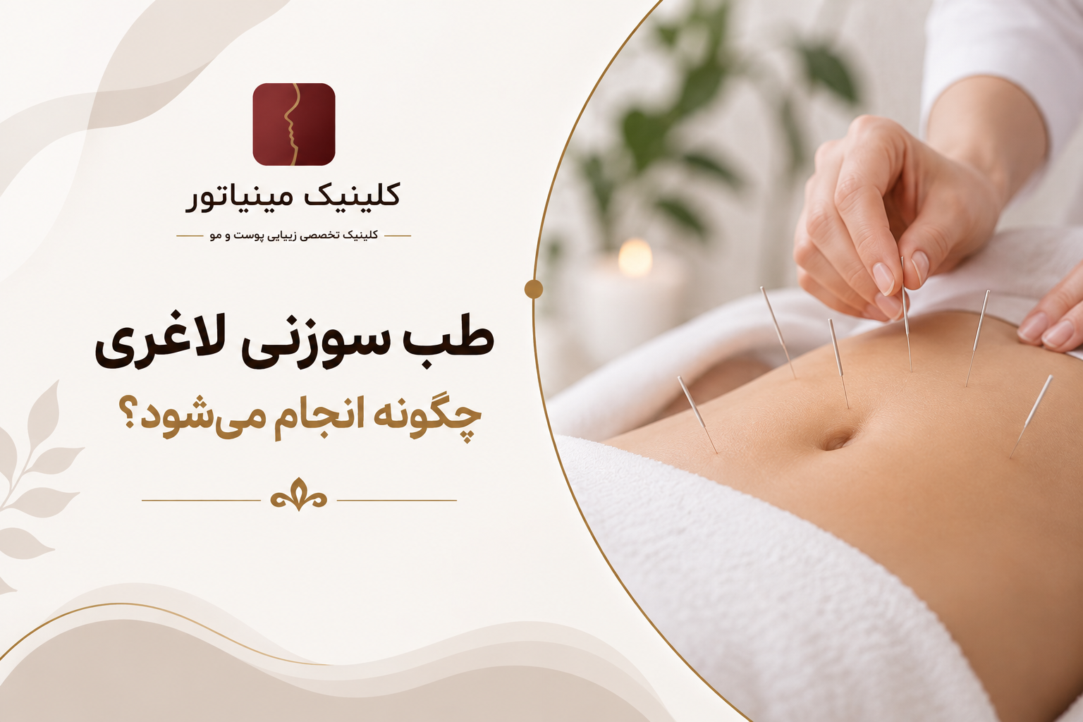 طب سوزنی لاغری